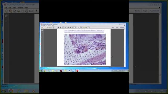 Консультация ко 2 коллоквиуму - Князева Л.А. (2 часть) "Остеогенез" смотреть онлайн