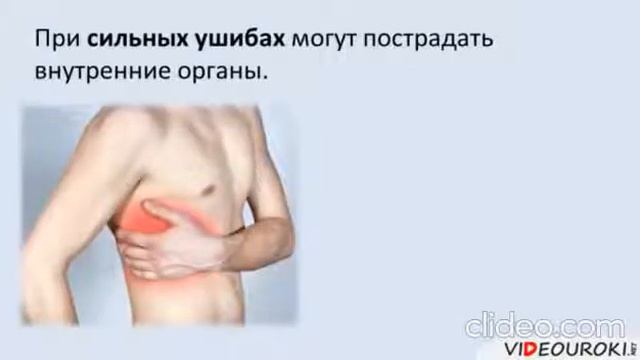 «Первая доврачебная помощь» Дом детского творчества Карабалыкского района смотреть онлайн