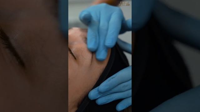 Черный пилинг ? смотреть онлайн