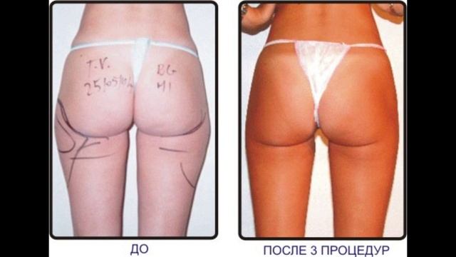 ДИЕТА СКИНУТЬ ЗА НЕДЕЛЮ 5-6 КГ смотреть онлайн