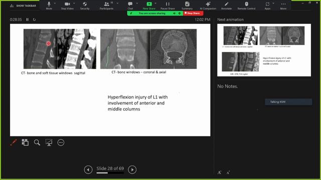Imaging andRadiological interventions for backache смотреть онлайн