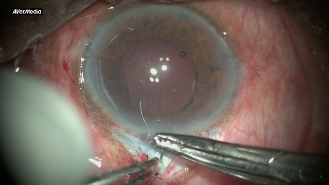 Dr. Md. Shahidul Islam VR Surgery operation смотреть онлайн