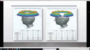 Защита от электромагнитной паутины Приборами Гамма 7  Презентация 2018 год