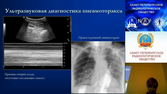 Нефёдова А.В. Ипатов В.В. Ультразвуковая диагностика острой дыхательной недостаточности смотреть онлайн