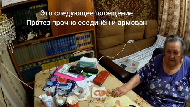 починка протеза смотреть онлайн