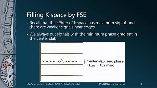 [2014.3.26 Lesson6-session1]Fast Spin Echo смотреть онлайн