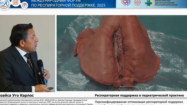 Граф мониторинг ИВЛ у детей Лоайса Уго Карлос смотреть онлайн