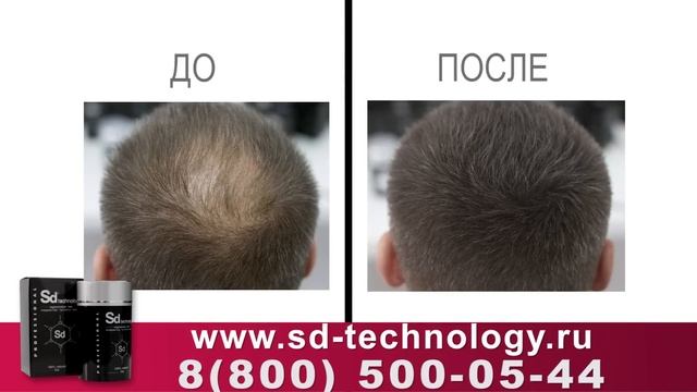 Корректор густоты волос Sd technology - густые волосы за 30 секунд! смотреть онлайн