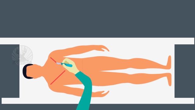 Autopsy :Detailed Animation On How Is Autopsy Done