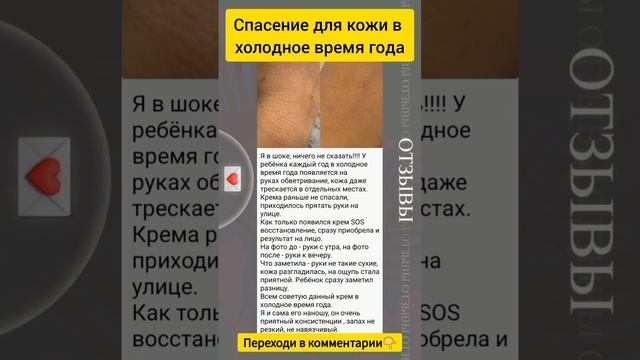 Спасение кожи в холодное время года смотреть онлайн