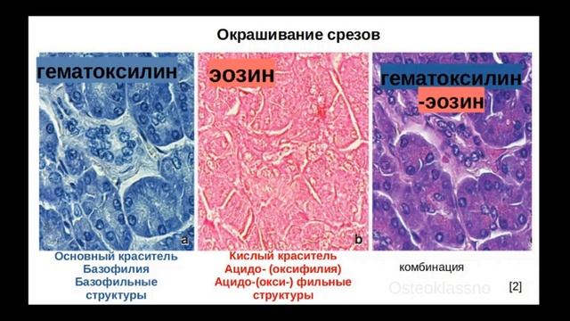 4 Гистологические методы. Виды красителей.mp4 смотреть онлайн
