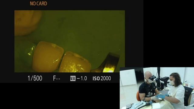 Live-Case.Фронтальные реставрации. Часть 3 смотреть онлайн