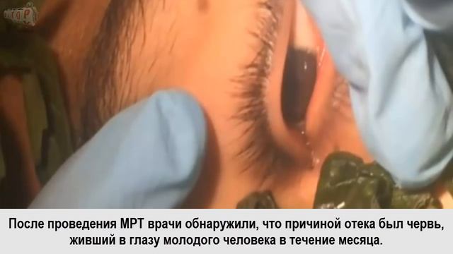 Toп 5 ужасающих находок внутри человеческого тела смотреть онлайн