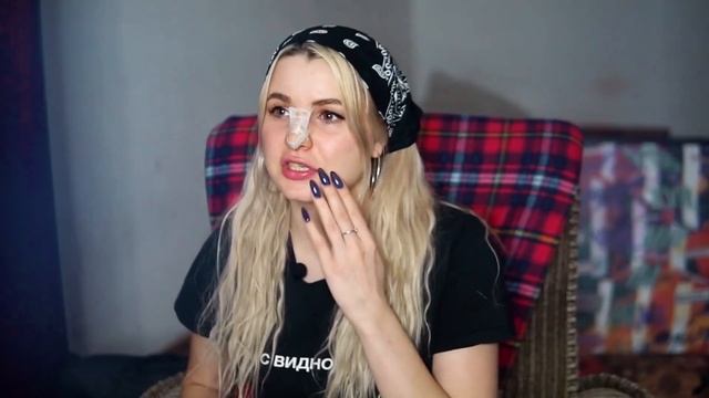 НОВЫЙ НОСЯРА! РИНОПЛАСТИКУ СДЕЛАЛА ААААААА ЗАЦЕНИТЕ смотреть онлайн
