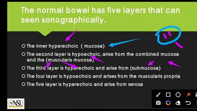 GIT ULTRASOUND | ELGAYLANI ALI | NSU смотреть онлайн