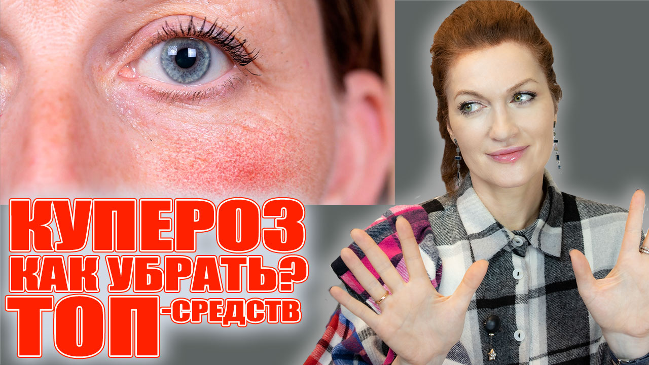 Полная система ухода против купероза! От очищения до ночной рутины. 100% результат! ??? смотреть онлайн