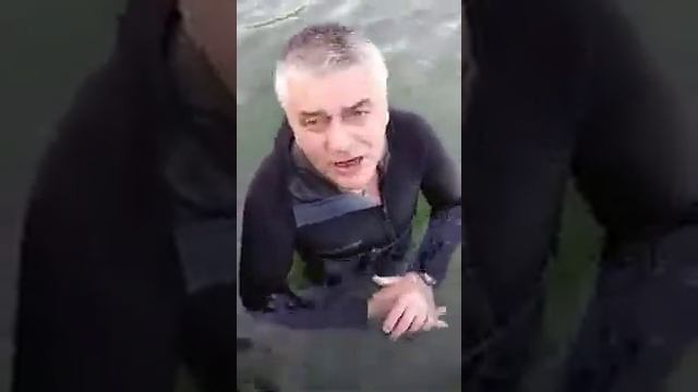 Рак кишечника(плоскоклеточный рак),1,2 ,3 стадии излечим смотреть онлайн