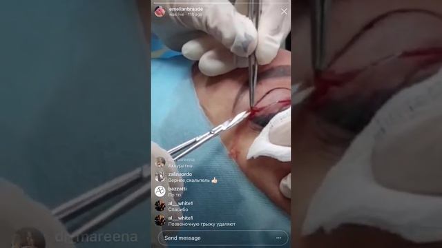 ? Как делать ГУБЫ ТП продолжение Браудэ смотреть онлайн