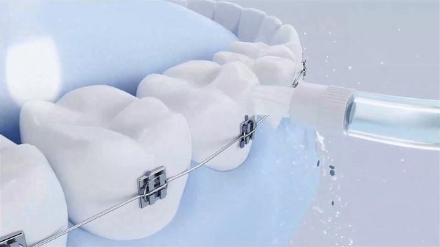 Ирригатор Soocas W3 Pro смотреть онлайн