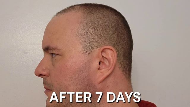 Derma E Vitamin C 14 Day Challenge and Review - Cleanser, Serum, Moisturizer, Night and Eye Cream смотреть онлайн