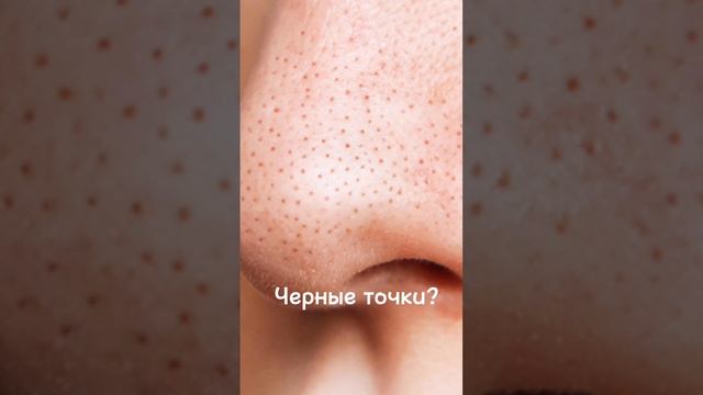 -2253460962728433241