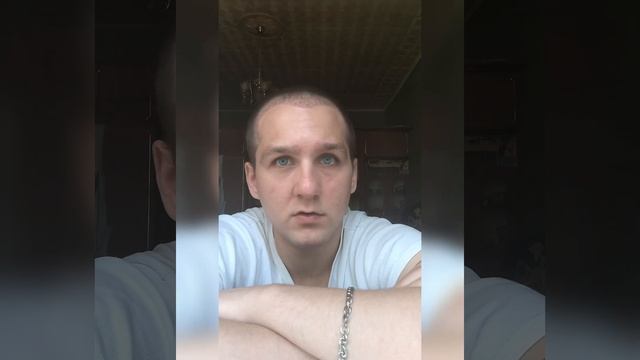 3 НЕДЕЛИ после пересадки волос в Москве. смотреть онлайн