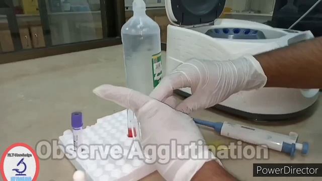 forward & reverse typing_blood typing (tube method) смотреть онлайн