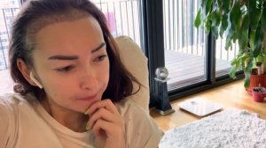 2 недели после пересадки (трансплантации) волос у женщины