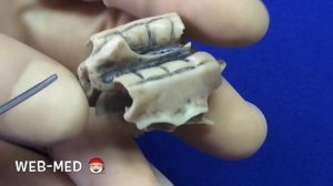 Решётчатая кость (Os Ethmoidale)