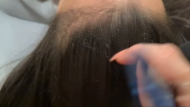 ASMR- Relaxing Scalp Check For Sleep / ZOOM #scratching #asmrsleep #scalp #tweezers #tailcomb