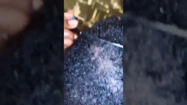 Lost Files big flakes dandruff scratching (Part 4) смотреть онлайн
