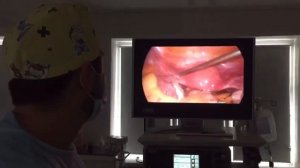 Анатомия женских половых органов