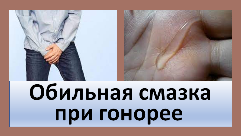 Обильная смазка при гонорее смотреть онлайн