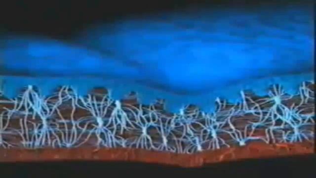 Морщины Почему появляются морщины Механизм старения нашей кожи смотреть онлайн
