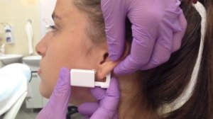 Прокол ушей системой 75. Безболезненный прокол ушей. Центр эпиляции и косметологии