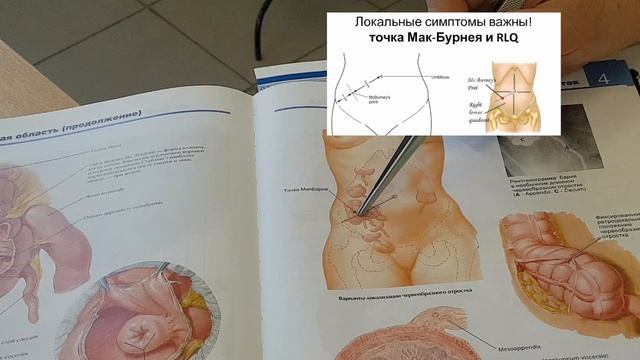 Аппендикс где находится?