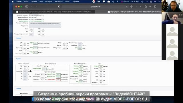 Леконцев Е.В. Анализ Эхографии смотреть онлайн