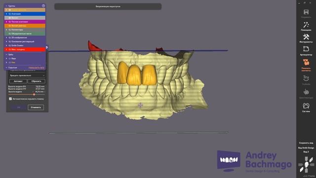 понедельничный exo-лайфхак - digital waxup model смотреть онлайн