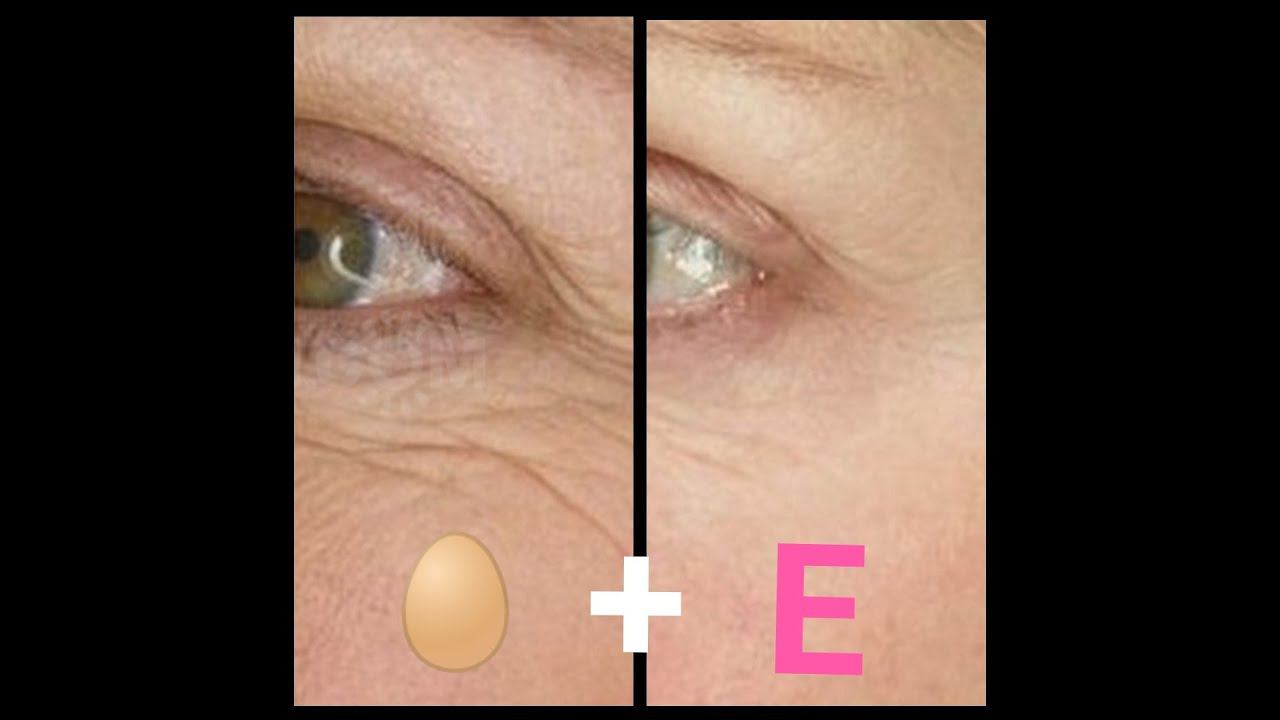 ШИКАРНАЯ маска от МОРЩИН вокруг ГЛАЗ ! Не верите ? Проверьте сами . смотреть онлайн