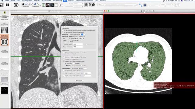 Продолжая дисскуссию про COVID и проценты теория и практика смотреть онлайн