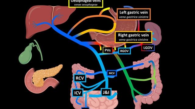 Portal Venous System & Porto-Caval Anastomosis (Tributaries and Clinical Significance) - Anatomy смотреть онлайн