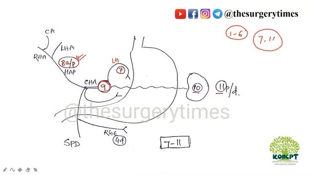 NEXT / EXIT Exam / NEET PG Gastric Lymphnode stations смотреть онлайн