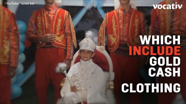 Turkish Circumcision Is An Extravagant Celebration