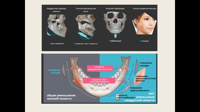 Заседание секции Пластическая хирургия: Чек-лифтинг, Шлифовка, смотреть онлайн