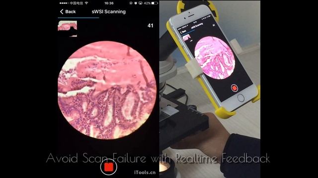 Smartphone Whole Slide Imaging(sWSI) Demo--Low Cost Slide Scanner. смотреть онлайн