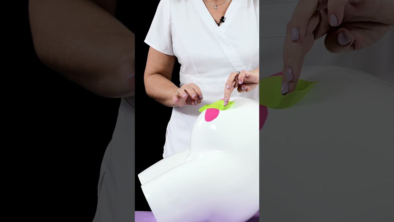 Тейпирование от пупочной грыжи у беременных смотреть онлайн