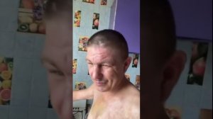 КАК БЫСТРО УБРАТЬ СИНЯК ПОД ГЛАЗОМ