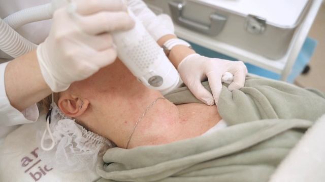 Лазерное удаление новообразований кожи смотреть онлайн