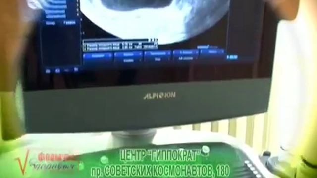 Гинеколог в Архангельске смотреть онлайн