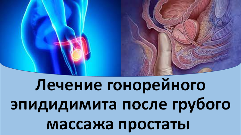 Лечение гонорейного эпидидимита после грубого массажа простаты смотреть онлайн
